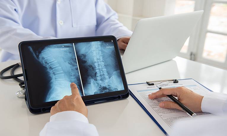 The Crucial Role of a Spinal Cord Injury Lawyer